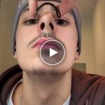 Dilatatore nasale magnetico – video